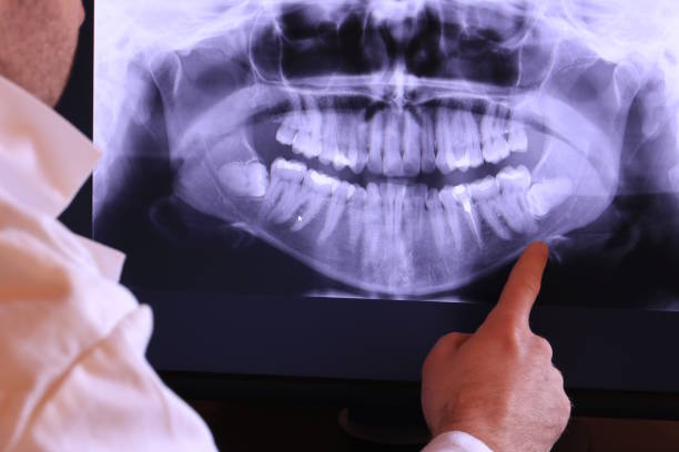 Best Emergency Tooth Extraction in Bayard, NE